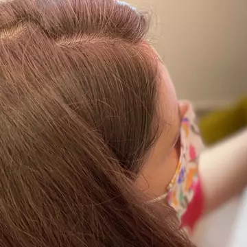 Tratamente de întinerire cu acid hialuronic