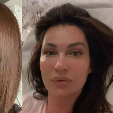 Nicoleta Luciu se duce săptămânal la clinica de înfrumusețare. De ce problemă încearcă să scape