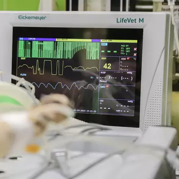 Tot ce trebuie să știi despre ecografia Doppler carotidian și cervical