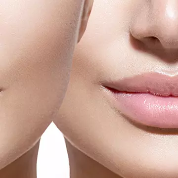 Cât durează acidul hialuronic în buze?