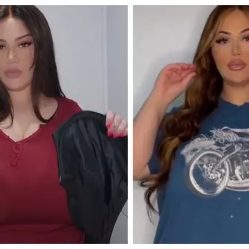 O femeie se plânge că sânii nu i se mai opresc din crescut. Cu ce afecțiune a fost diagnosticată
