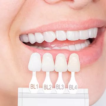 5 lucruri pe care trebuie să le știi înainte să mergi la dentist