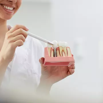 Avantajele și dezavantajele implantului dentar