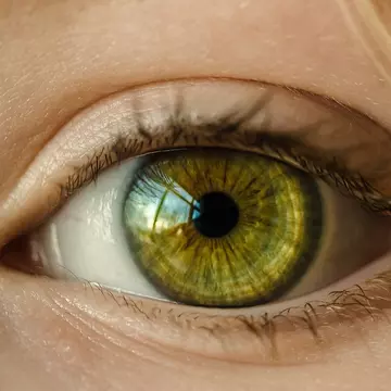 Glaucomul, boala fără simptome care te poate lăsa fără vedere. Cum poate fi detectată la timp afecțiunea