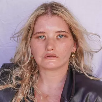 Tânăra care nu poate zâmbi îi sfidează pe cei care au hărțuit-o și devine model: "Am darul incredibil de a-i inspira pe ceilalți"