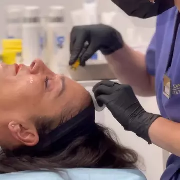 De la problemele cu acneea, la rezultate spectaculoase: Tratamente personalizate pentru fiecare tip de ten la clinica Zeus Med by Dr. Pascal Dameh