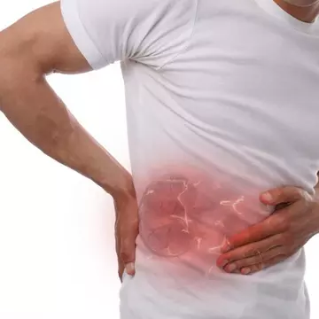 Pietrele la rinichi - cauze, simptome și opțiuni de tratament