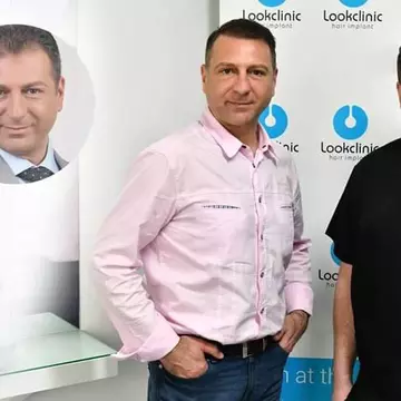 Mit sau realitate? Implantul de păr este o procedură permanentă