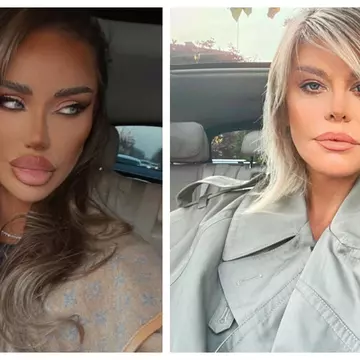 Bianca Drăgușanu o acuză pe Loredana Groza că nu își recunoaște operațiile estetice: „Eu nu spun că mă dau cu cremă de gălbenele”