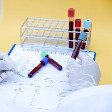 Ce teste medicale sunt necesare, în funcție de vârstă, pentru depistarea bolilor. Kate Middelton și-a descoperit cancerul în fază incipientă