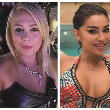 6 vedete din România care au avut probleme cu tenul. Nicoleta Luciu: „Am rămas cu semne de față”