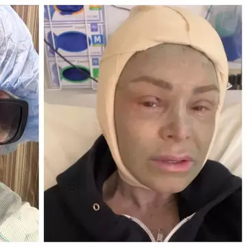 Se număra printre frumusețile din lumea televiziunii, dar a ajuns de nerecunoscut din cauza intervenţiilor estetice