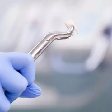 Un bărbat a murit după ce medicul stomatolog i-a extras 23 de dinți într-o zi