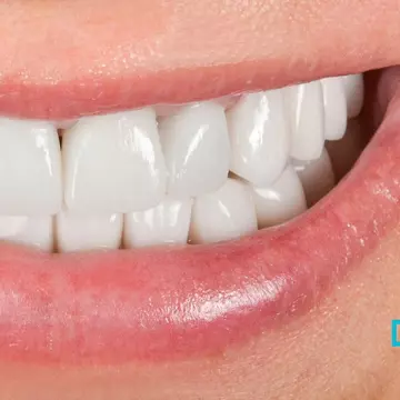 Ghidul tău pentru un zâmbet perfect: descoperă cele mai populare proceduri de estetică dentară