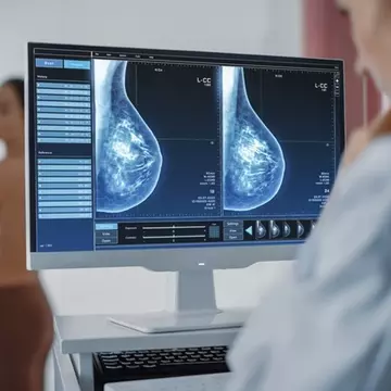 MedLife își consolidează poziția pe segmentul de oncologie printr-un nou parteneriat cu Institutul Sânului, extinzând serviciile dedicate tratamentului cancerului mamar