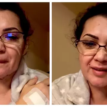 Minodora a apelat la o intervenție estetică, după ce a slăbit 40 de kilograme: „Sinceră și transparentă”