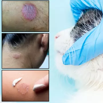 Transmiterea dermatofitozei de la pisici la oameni
