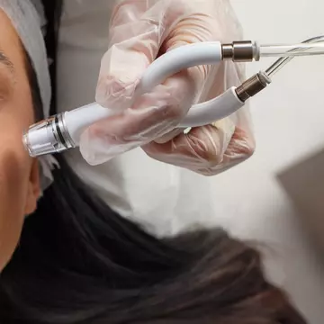 Dermalinfusion la AMOO Klinik – Cel mai bun tratament facial pentru reducerea hiperpigmentării