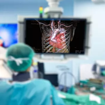 Ce afecțiuni sunt tratate prin chirurgie toracică?