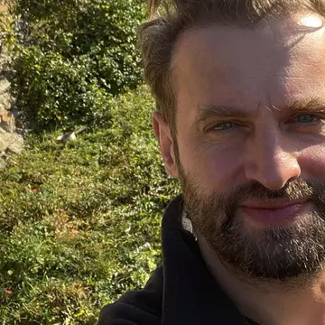 Sorin Brotnei a apelat la o nouă intervenție estetică. Artistul nu are voie să iasă din casă: „Nu pot ieși așa pe stradă!”