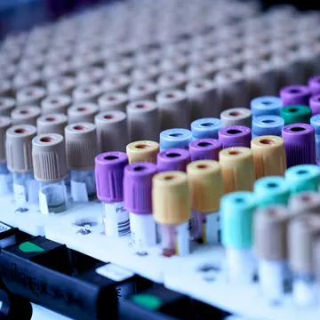 Ce analize sunt esențiale pentru monitorizarea sănătății tale