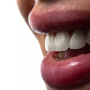 Ce înseamnă un plan de tratament personalizat la Delta Clinic Dent