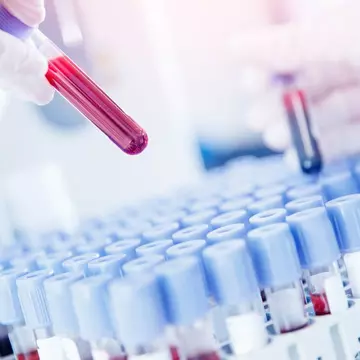 Ce ascund oboseala, răcelile frecvente sau pielea uscată. Explicațiile medicului specialist