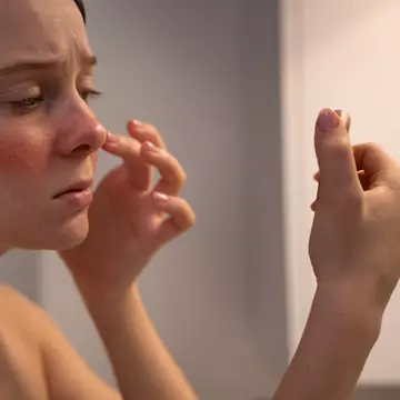 Cele mai comune 10 afecțiuni ale pielii și ce trebuie să știi despre fiecare