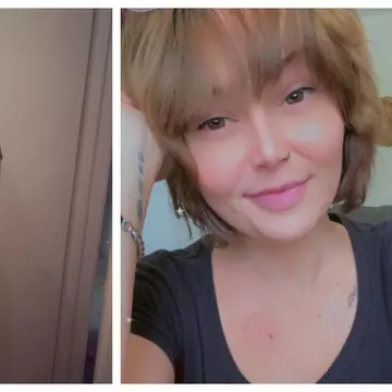 O femeie de 27 de ani a rămas fără piele din cauza unui medicament comun. Medicii i-au dat 5% șanse de supraviețuire