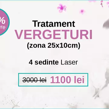 Când este momentul potrivit să faci un tratament pentru vergeturi