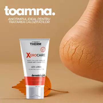 Toamna – momentul ideal să tratezi calozitățile