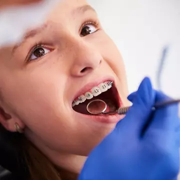 Importanța tratamentului ortodontic la copii