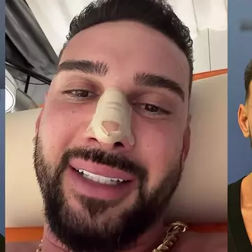 Cum arată Dorian Popa după operația la nas. Vloggerul și-a dat jos bandajele: „Exact ce îmi doream!”