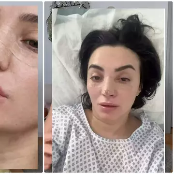 Ana Morodan, adevărul despre intervențiile estetice suferite. Vedeta a mers până în pânzele albe ca să arate așa cum își dorește