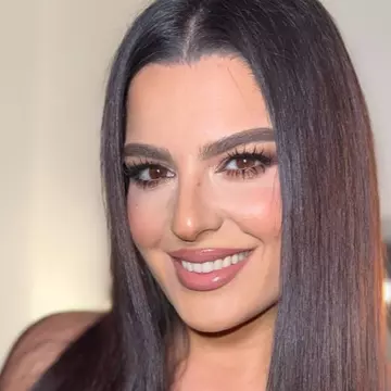 Ioana State a ajuns la medicul estetician: „Mi-am făcut de toate”. Cum arată acum comedianta, după ce și-a făcut mai multe operații estetice