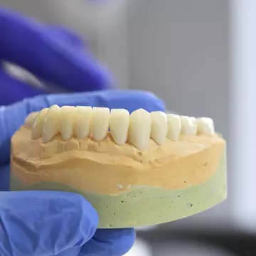 Tipuri de coroane dentare: zirconiu, ceramică sau metalo-ceramică