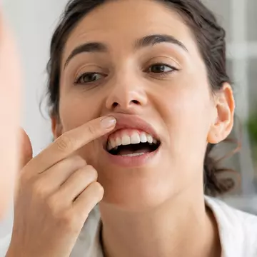 Semne că gingiile tale au nevoie de atenție, chiar dacă nu te dor