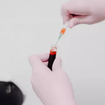 Cum te ajută Synevo să înțelegi mai bine semnalele transmise de organism