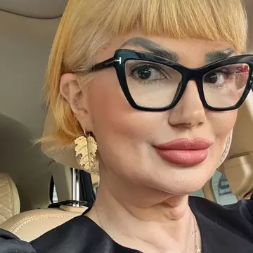 Cum arată Ozana Barabancea după liftingul facial. Vedeta a mărturisit că se vindecă greu: „Am rezultatul dorit”