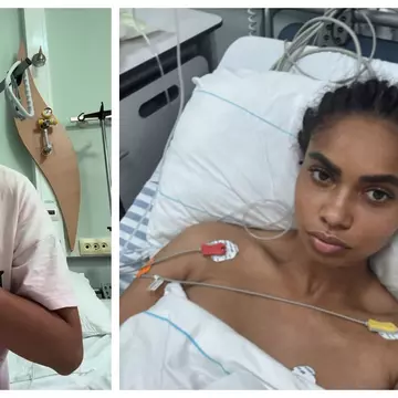 Laurette, salvată de la amputare după mai bine de 30 de operații. "A fost cel mai groaznic an din viața mea!" Prin ce trece acum