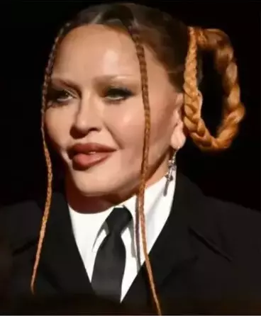 madonna-operatii estetice