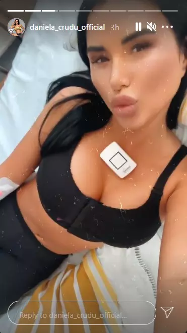Daniela-Crudu-operatie-estetica1