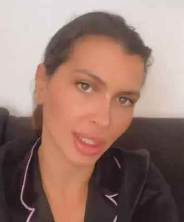 Madalina-Pamfile-lipsa-1