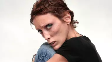 Cum arată anorexia
