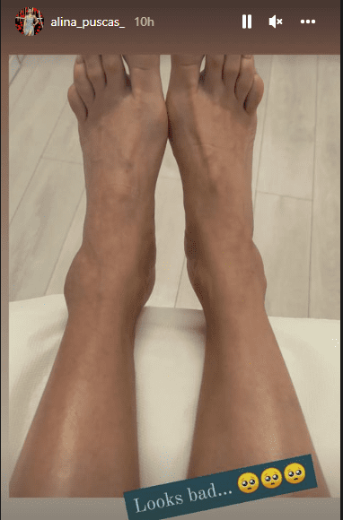 Alina Puscas s-a lovit la piciir