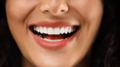 Dincolo de estetică: valoarea reală a investiției într-un zâmbet perfect