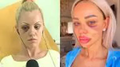 Vedetele din România, victime ale violenței domestice. Au povestit public prin ce au trecut