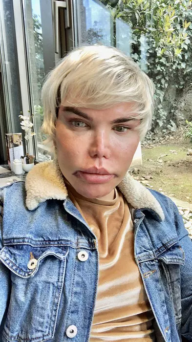 FORMER HUMAN KEN COMPLETES TRANSITION WITH SEX CHANGE