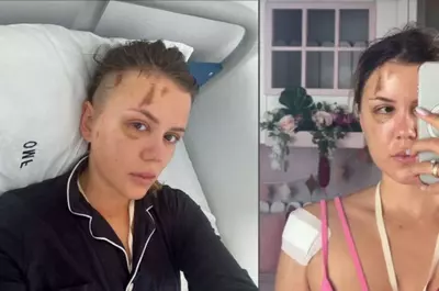 Emily Burghelea a răbufnit după ce Radu Ciucă a acuzat-o că și-a înscenat accidentul din Mauritius: "Am purtat săptămâni întregi o atelă metalică în cap și am petrecut o lună întreagă fără să îmi pot lua copiii în brațe"