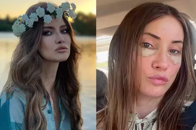 Iulia Albu și-a făcut lifting facial, la 44 de ani. Cum arată după operația estetică: „Procedura a reprezentat primul pas, urmat de un protocol de recuperare, perfuzii și tratamente”